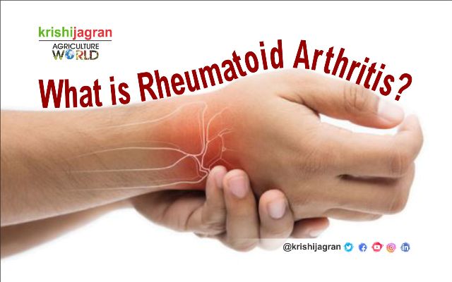 Rheumatoid Arthritis Early Signs, Symptoms & Treatment