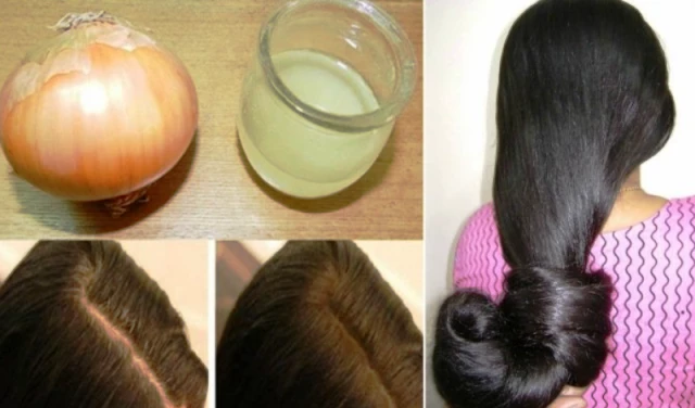 Do You Know Onion Is A Miraculous Remedy For Hair Growth